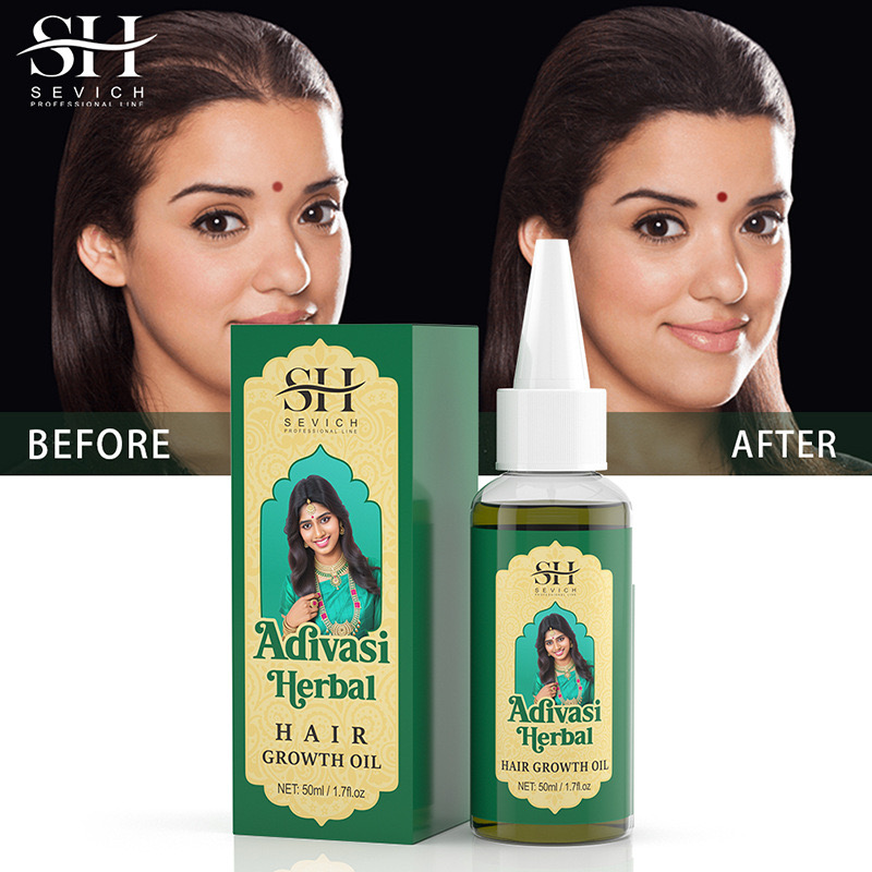 Ayurvedic & Herbal Wellness Kits - 50ml 오리지널 인도 오일 Adivasi 허벌