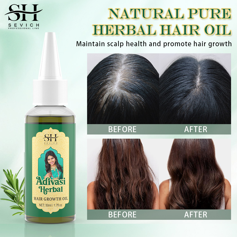 아유르베다 모발 성장 오일 Adivasi 유기농 모발  - Ayurvedic & Herbal Wellness Kits 리뷰 및 가격